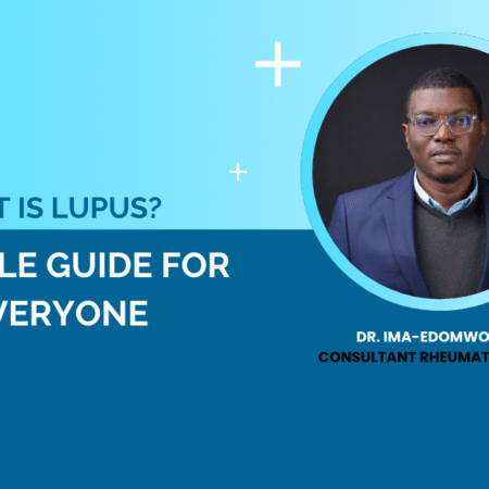 lupus